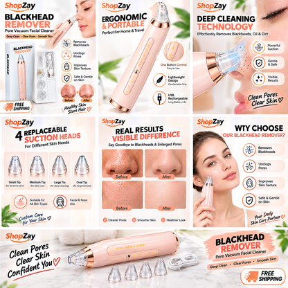 Blackhead Remover Pore Vacuum Facial Cleaner | Deep Pore Cleaning & Blackhead Removal