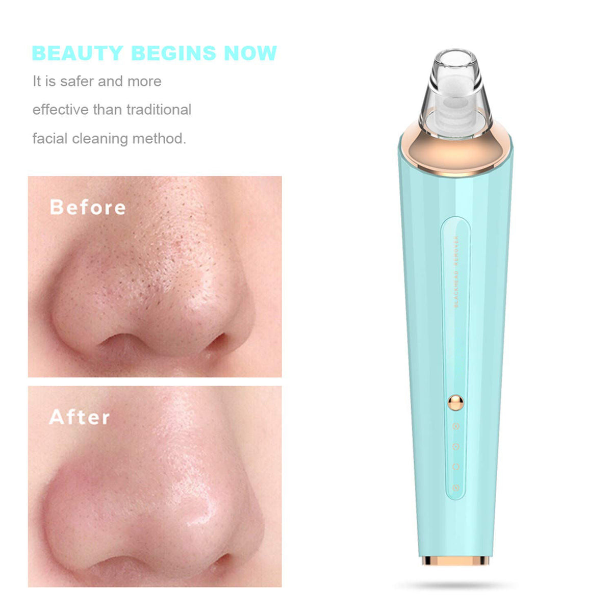 Blackhead Remover Pore Vacuum Facial Cleaner | Deep Pore Cleaning & Blackhead Removal