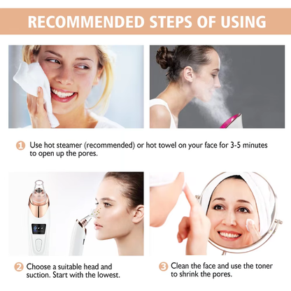 Electric Black Head Remover